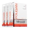 Minoxidil 5% hair growth foam for men
